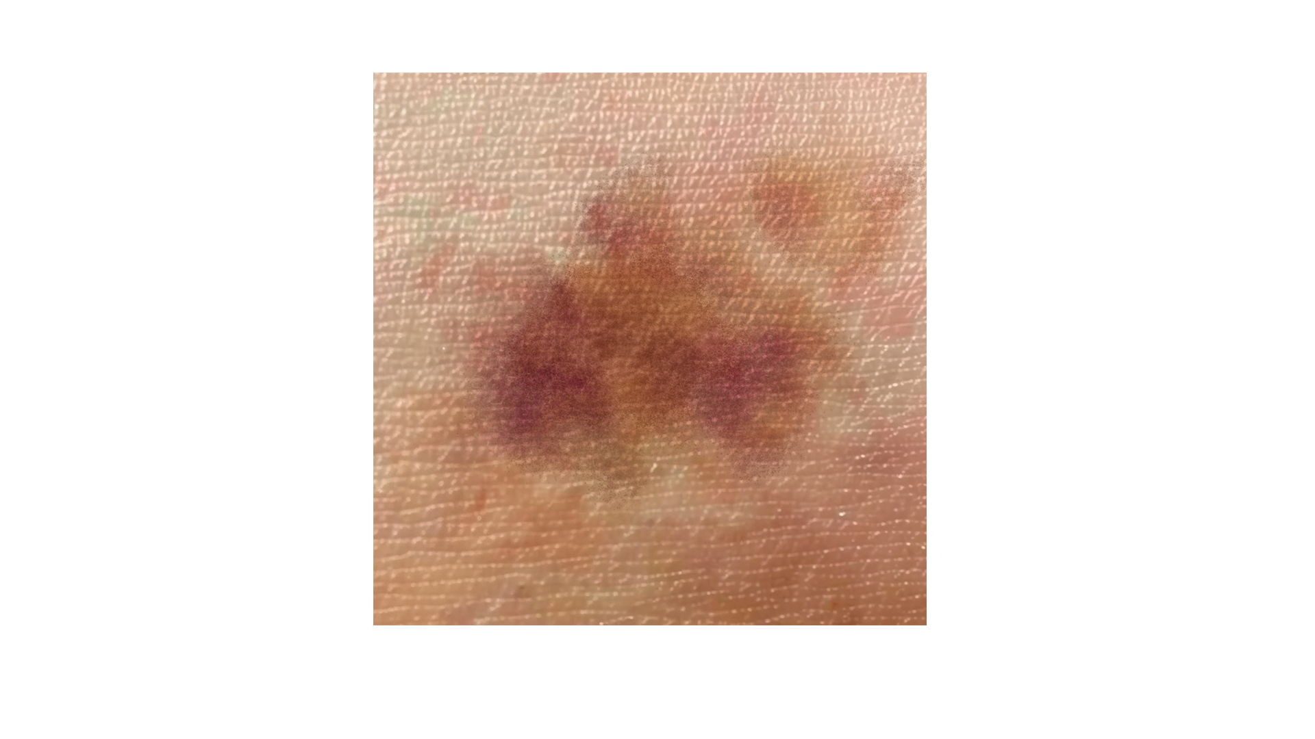 스크롤 이미지 2