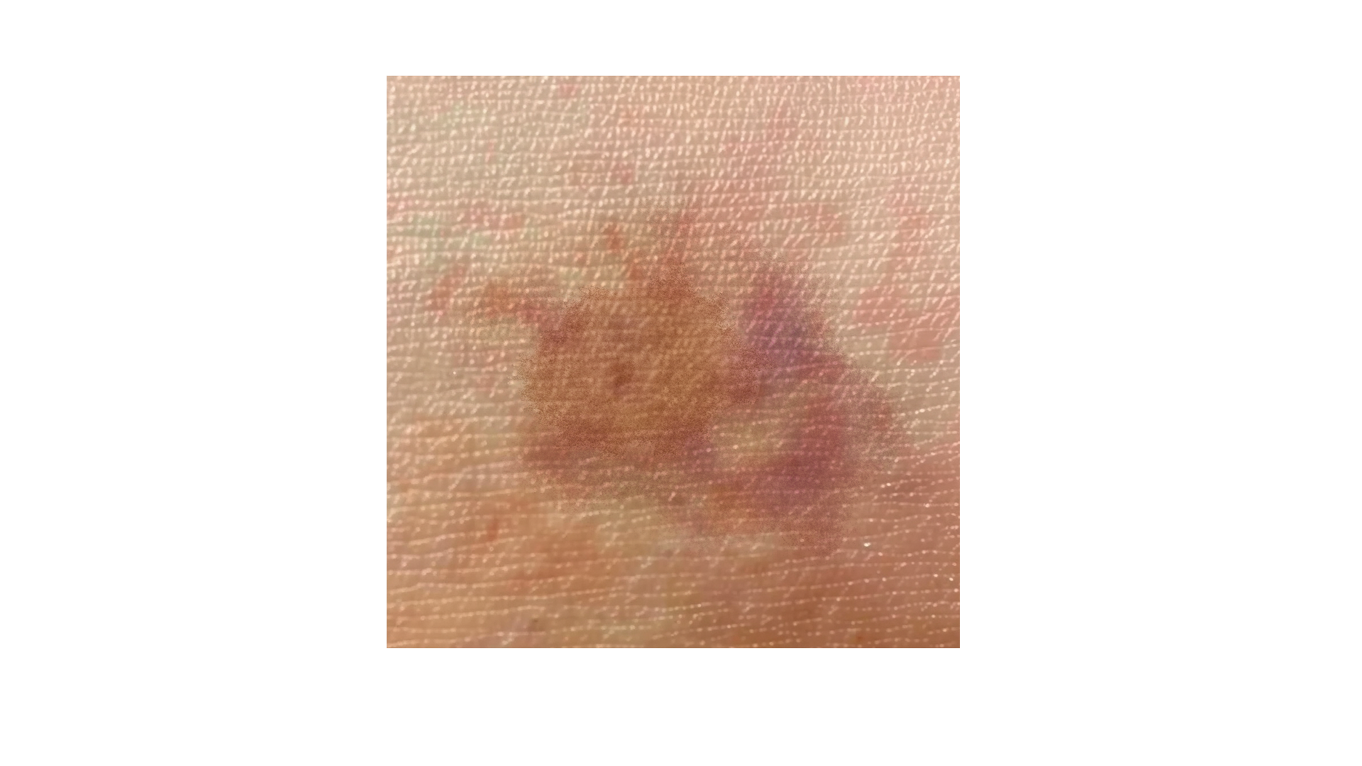 스크롤 이미지 3