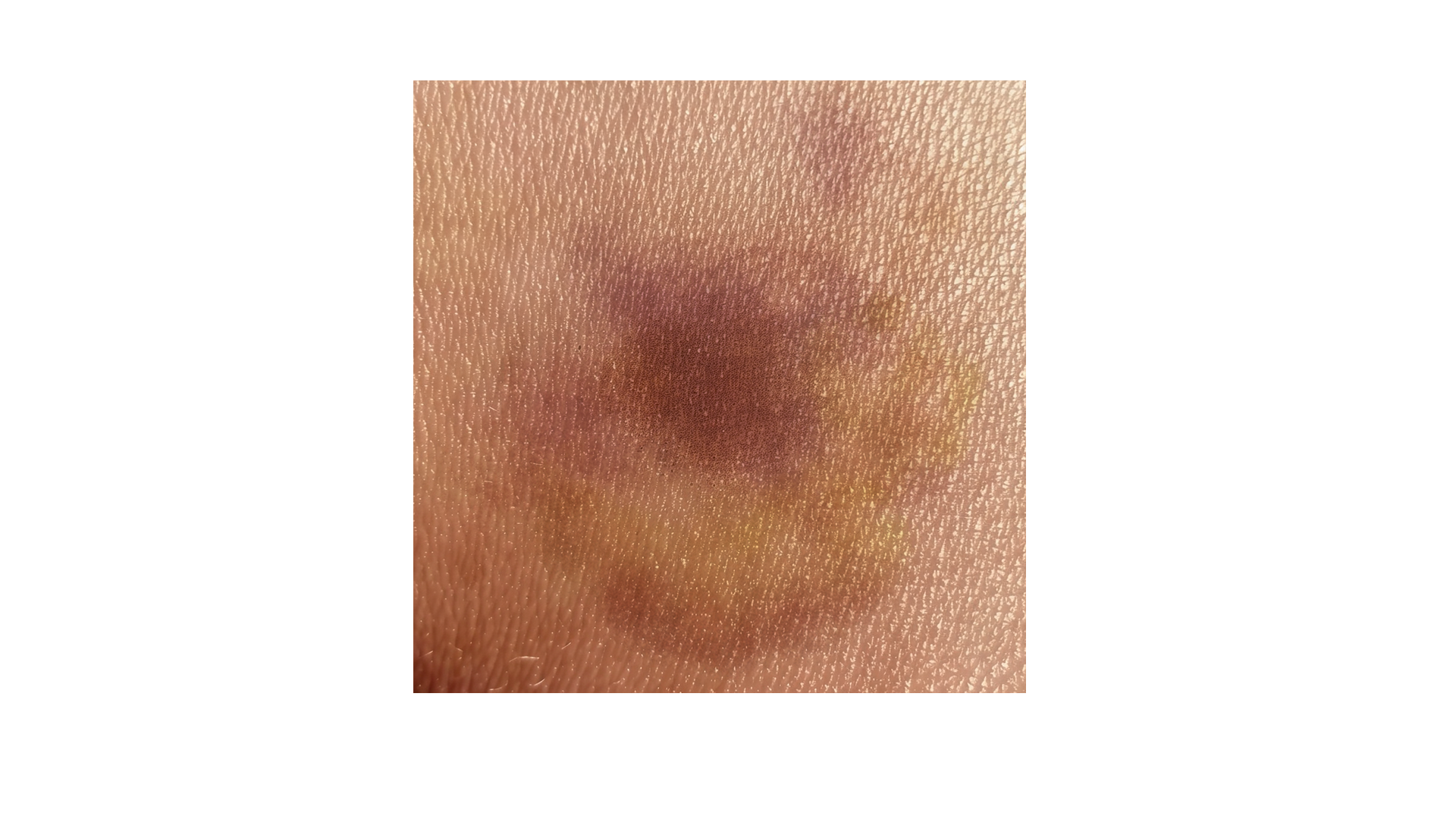 스크롤 이미지 3