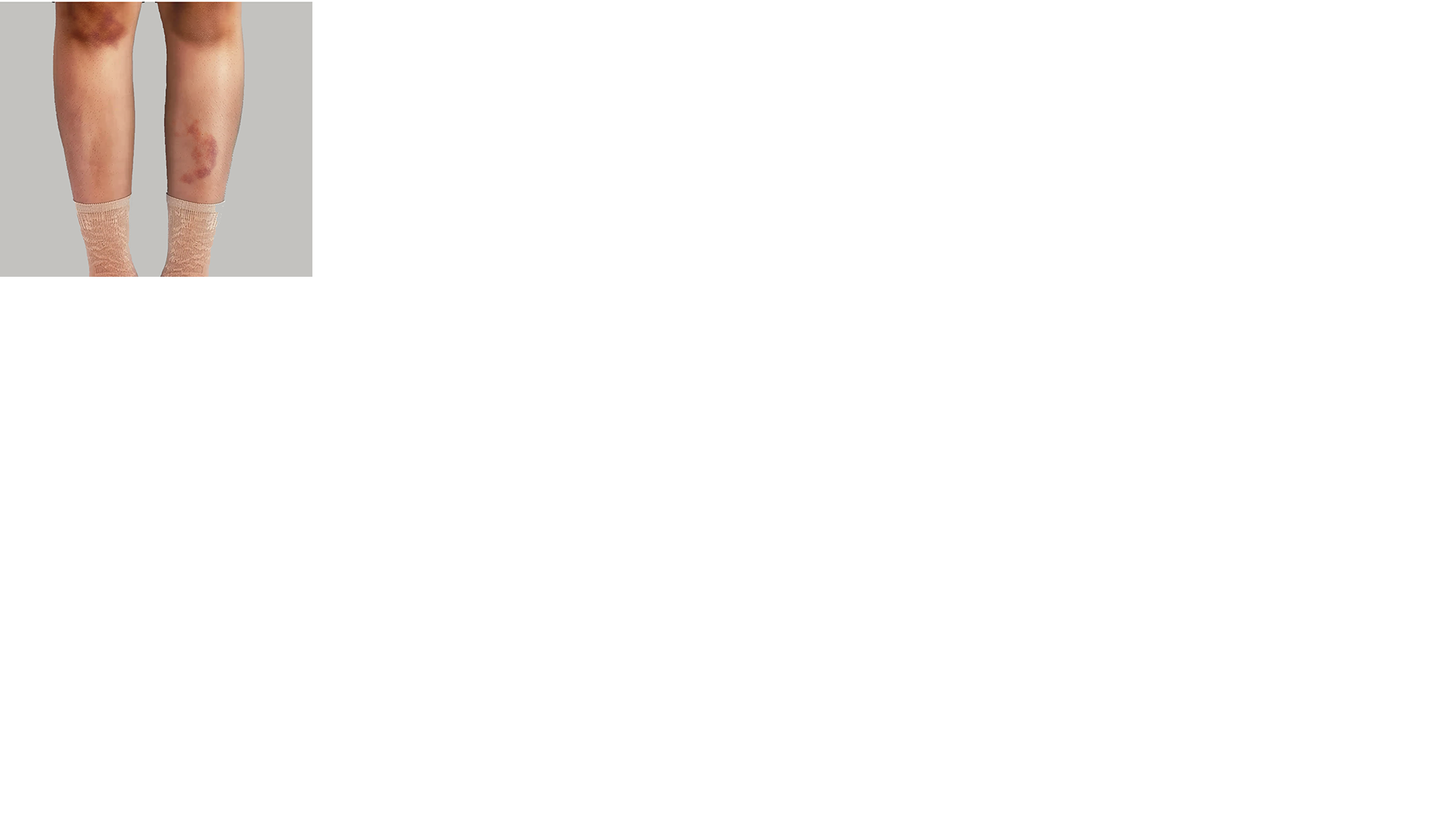 스크롤 이미지 3